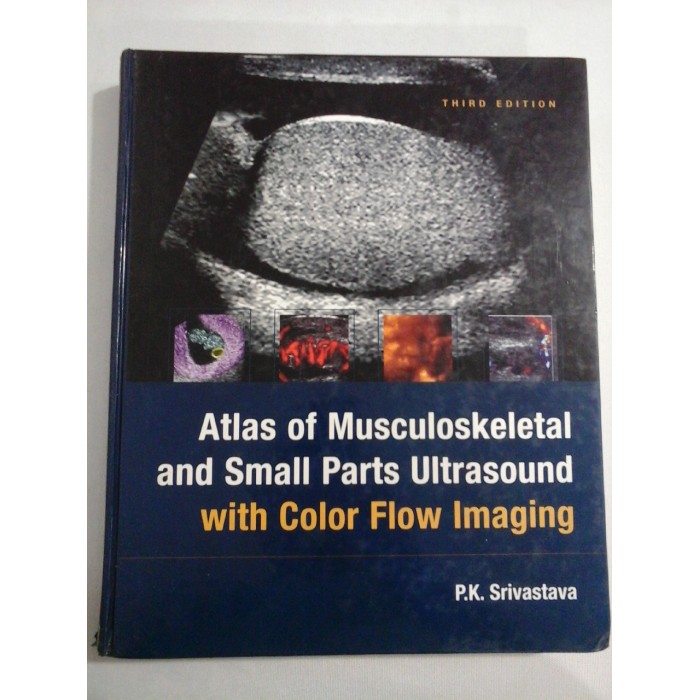 ATLAS OF MUSCULOSKELETAL AND SMALL PARTS ULTRASOUND WITH COLOR FLOW IMAGING - SRIVASTAVA (ecografie) ATLAS OF MUSCULOSKELETAL AND SMALL PARTS ULTRASOUND WITH COLOR FLOW IMAGING - SRIVASTAVA (ecografie)